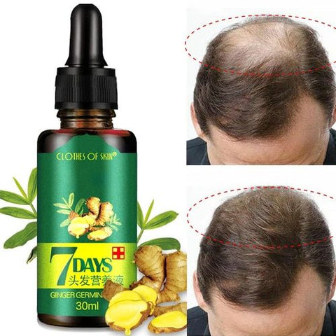 Hair Growth Serum - dazzy