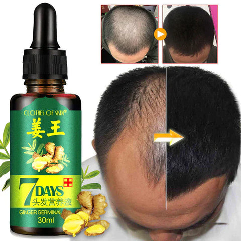 Hair Growth Serum - dazzy